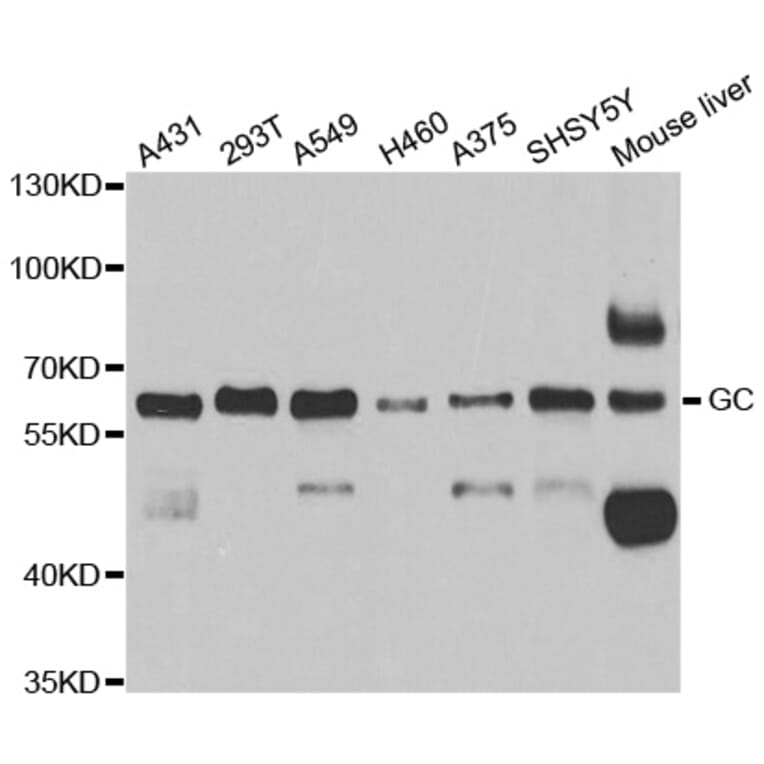 Western blot - GC antibody from Signalway Antibody (38683) - Antibodies.com