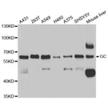 Western blot - GC antibody from Signalway Antibody (38683) - Antibodies.com
