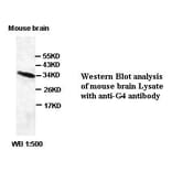 G4 Antibody from Signalway Antibody (39405) - Antibodies.com