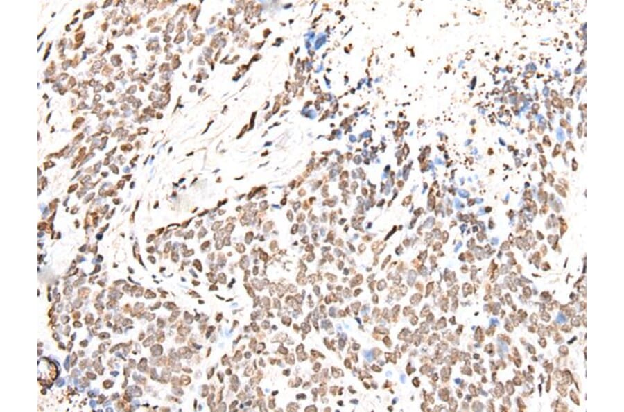 HIST1H2BJ Antibody from Signalway Antibody (43683) - Antibodies.com