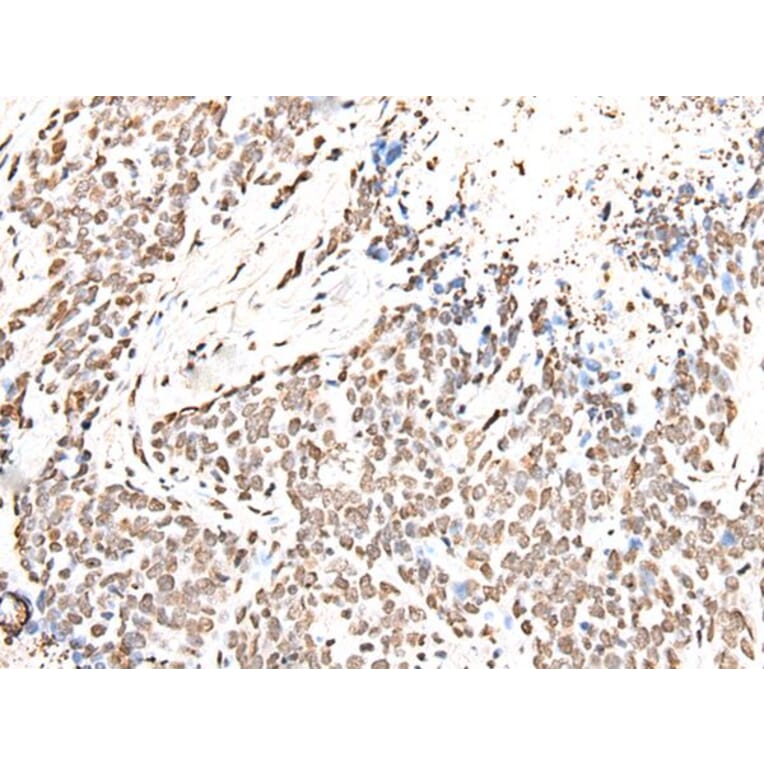 HIST1H2BJ Antibody from Signalway Antibody (43683) - Antibodies.com