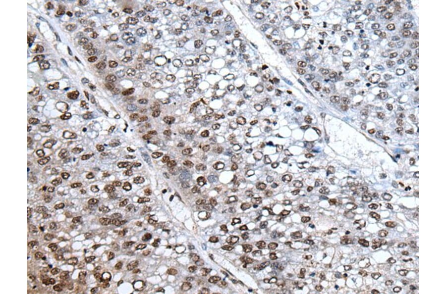 HIST1H3A Antibody from Signalway Antibody (43793) - Antibodies.com