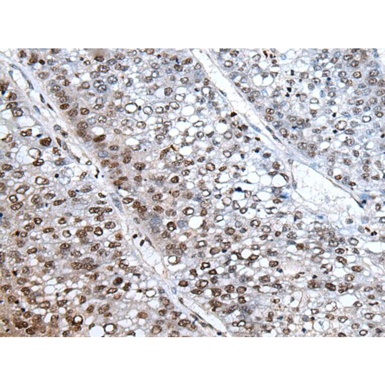 HIST1H3A Antibody from Signalway Antibody (43793) - Antibodies.com