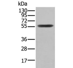 CLU/APOJ Antibody from Signalway Antibody (43901) - Antibodies.com