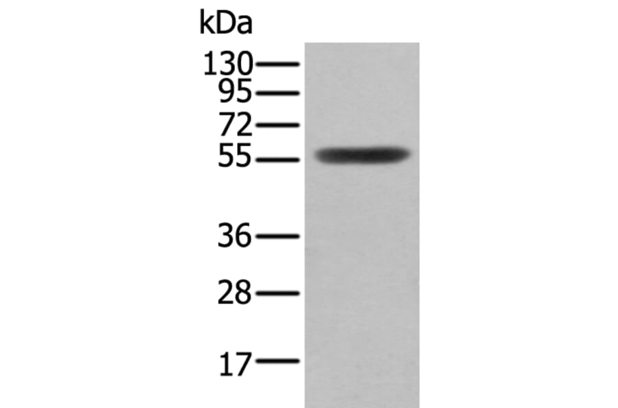 CLU/APOJ Antibody from Signalway Antibody (43901) - Antibodies.com
