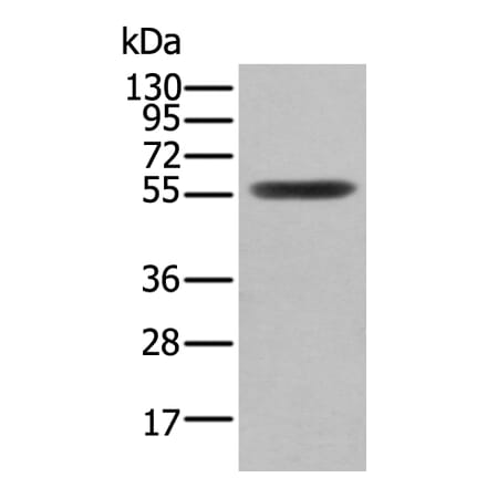 CLU/APOJ Antibody from Signalway Antibody (43901) - Antibodies.com