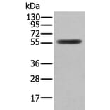 CLU/APOJ Antibody from Signalway Antibody (43901) - Antibodies.com