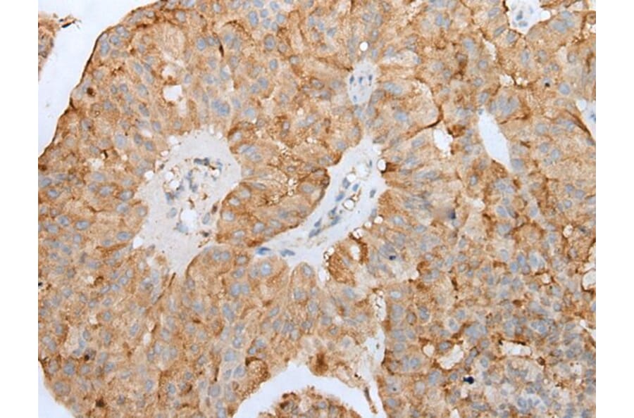 CLU/APOJ Antibody from Signalway Antibody (43901) - Antibodies.com
