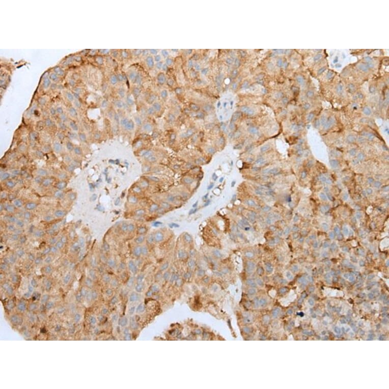 CLU/APOJ Antibody from Signalway Antibody (43901) - Antibodies.com
