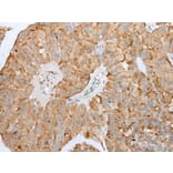 CLU/APOJ Antibody from Signalway Antibody (43901) - Antibodies.com