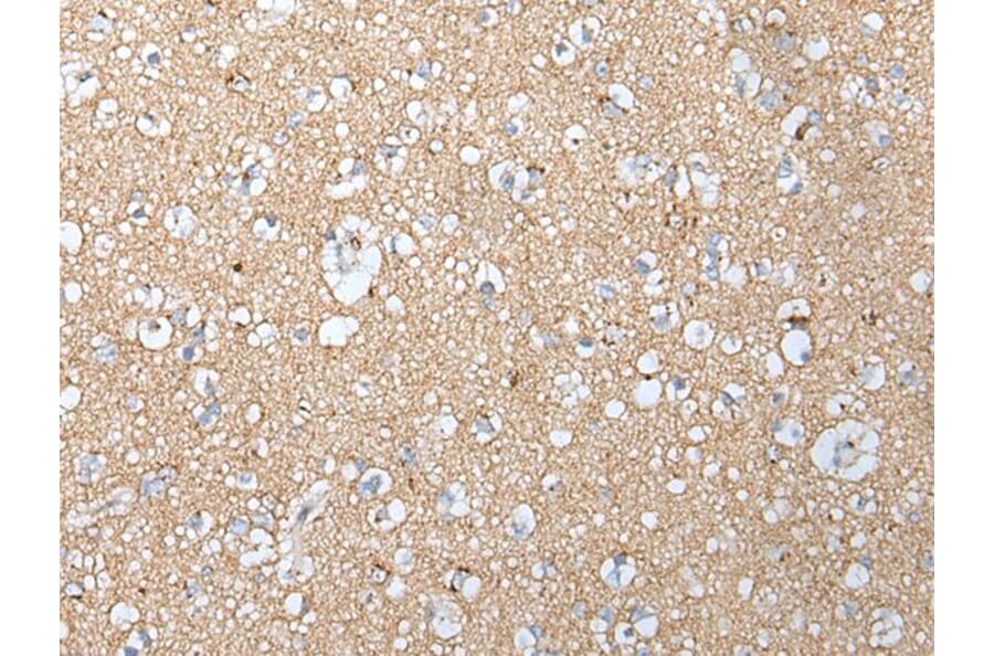 CLU/APOJ Antibody from Signalway Antibody (43901) - Antibodies.com