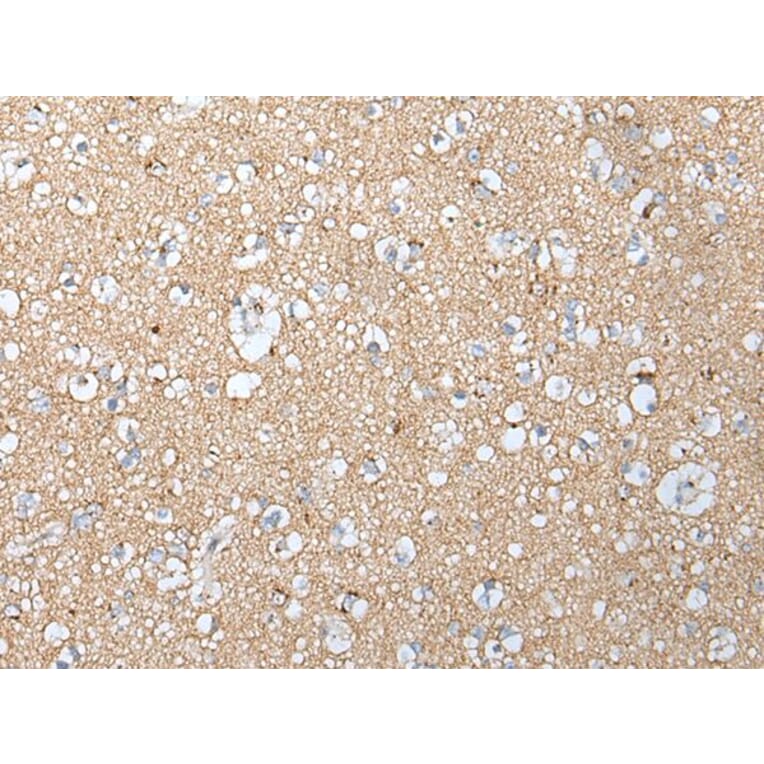 CLU/APOJ Antibody from Signalway Antibody (43901) - Antibodies.com