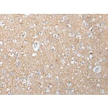 CLU/APOJ Antibody from Signalway Antibody (43901) - Antibodies.com