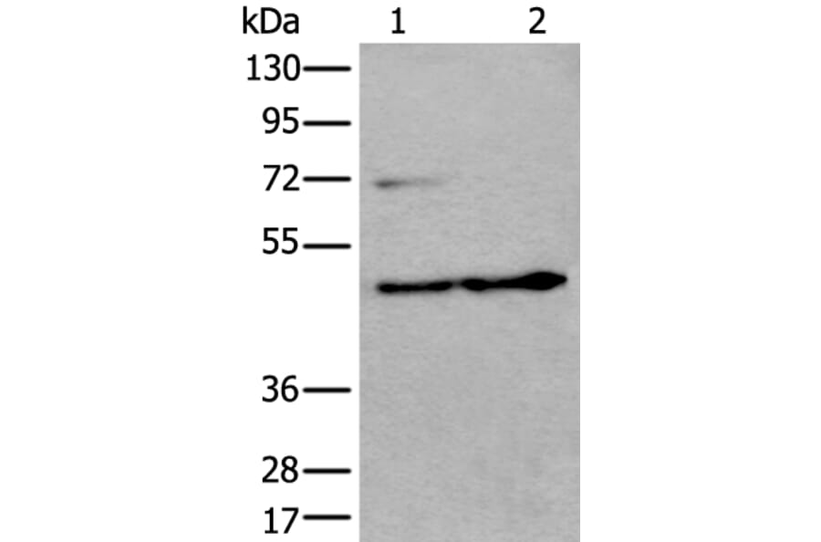 PRKAR2A Antibody from Signalway Antibody (43522) - Antibodies.com
