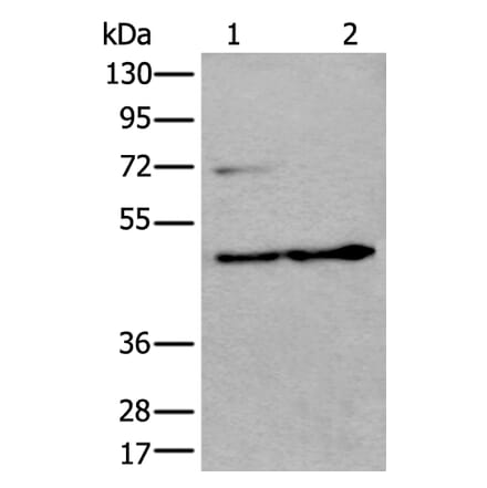 PRKAR2A Antibody from Signalway Antibody (43522) - Antibodies.com