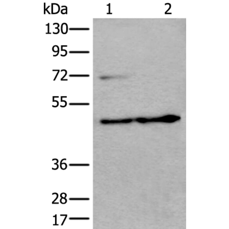 PRKAR2A Antibody from Signalway Antibody (43522) - Antibodies.com