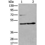 PRKAR2A Antibody from Signalway Antibody (43522) - Antibodies.com