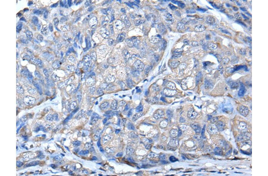 PRKAR2A Antibody from Signalway Antibody (43522) - Antibodies.com