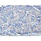 PRKAR2A Antibody from Signalway Antibody (43522) - Antibodies.com