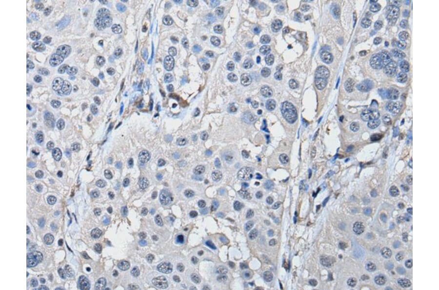 PRKAR2A Antibody from Signalway Antibody (43522) - Antibodies.com