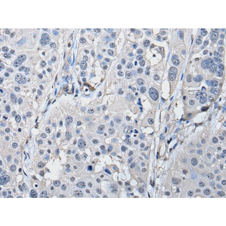 PRKAR2A Antibody from Signalway Antibody (43522) - Antibodies.com