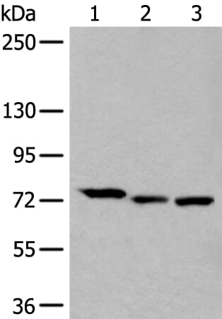 Gel: 6%SDS-PAGE Lysate: 40 &#956;g, Lane 1-3: HEPG2£¬Hela and PC-3 cell lysates, Primary antibody: SLC27A4 antibody at dilution 1/250, Secondary antibody: Goat anti rabbit IgG at 1/8000 dilution, Exposure time: 1 minute