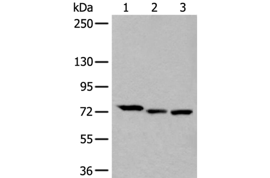 SLC27A4 Antibody from Signalway Antibody (43537) - Antibodies.com