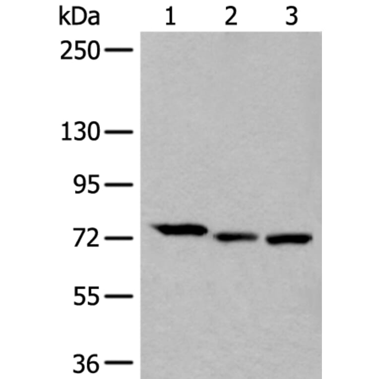 SLC27A4 Antibody from Signalway Antibody (43537) - Antibodies.com