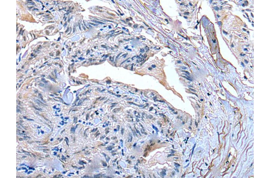 SLC27A4 Antibody from Signalway Antibody (43537) - Antibodies.com