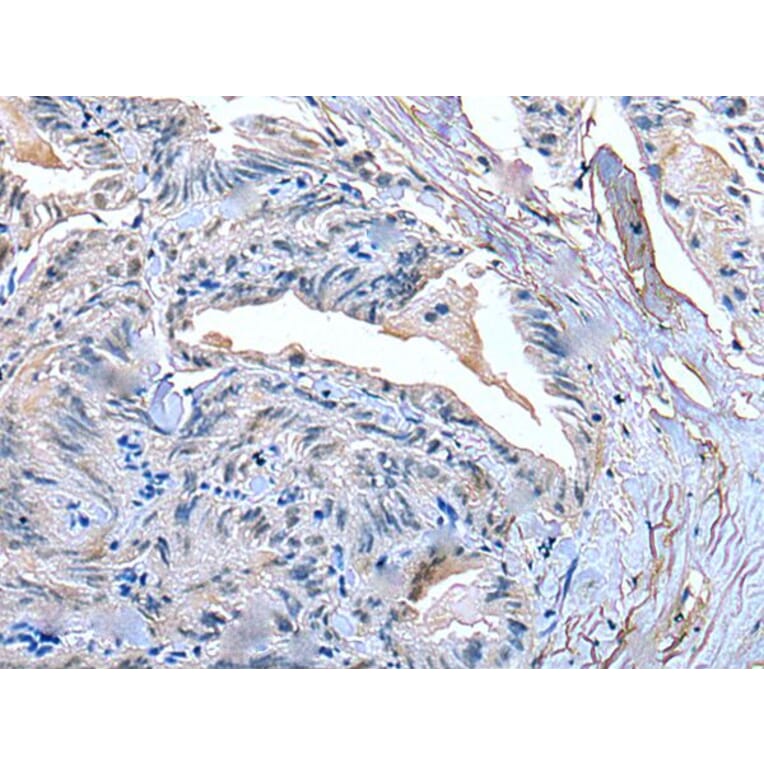 SLC27A4 Antibody from Signalway Antibody (43537) - Antibodies.com