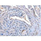 SLC27A4 Antibody from Signalway Antibody (43537) - Antibodies.com