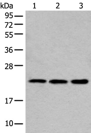 Gel: 12% SDS-PAGE Lysate: 40 &#956;g, Lane 1-3: HEPG2,293T and Hela cell lysates, Primary antibody: COMMD10 antibody at dilution 1/250, Secondary antibody: Goat anti rabbit IgG at 1/8000 dilution, Exposure time: 1 minute