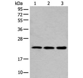 COMMD10 Antibody from Signalway Antibody (43551) - Antibodies.com