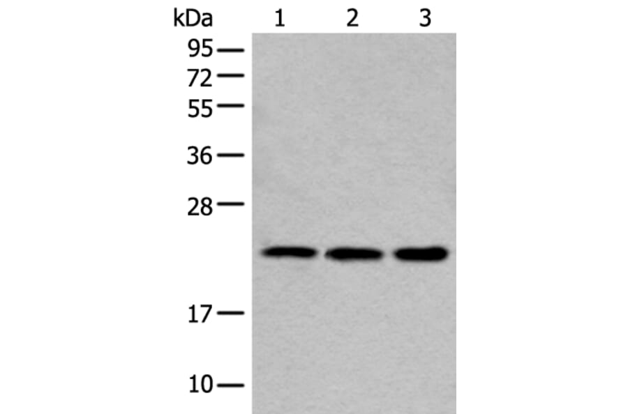 COMMD10 Antibody from Signalway Antibody (43551) - Antibodies.com