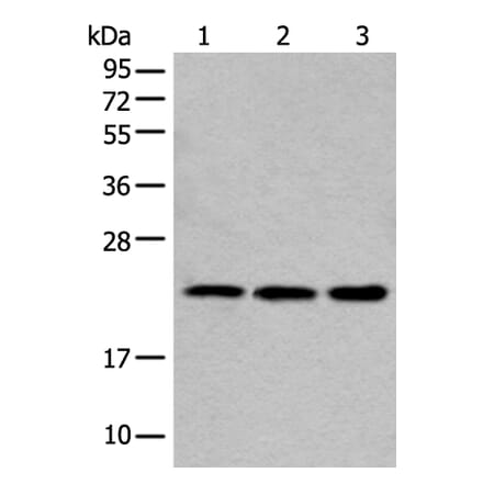 COMMD10 Antibody from Signalway Antibody (43551) - Antibodies.com