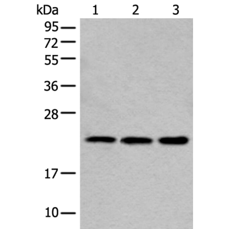 COMMD10 Antibody from Signalway Antibody (43551) - Antibodies.com