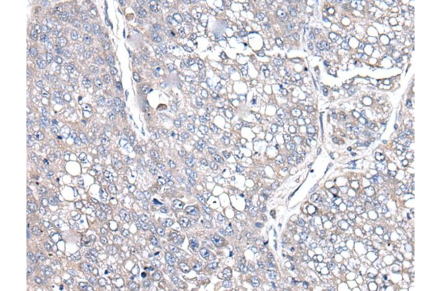 COMMD10 Antibody from Signalway Antibody (43551) - Antibodies.com