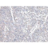 COMMD10 Antibody from Signalway Antibody (43551) - Antibodies.com