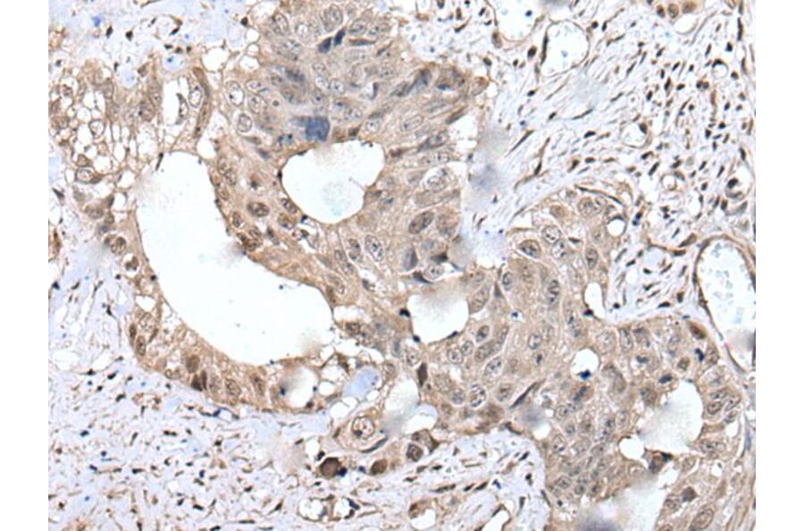 COMMD10 Antibody from Signalway Antibody (43551) - Antibodies.com