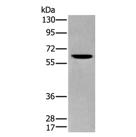 ZKSCAN1 Antibody from Signalway Antibody (43569) - Antibodies.com