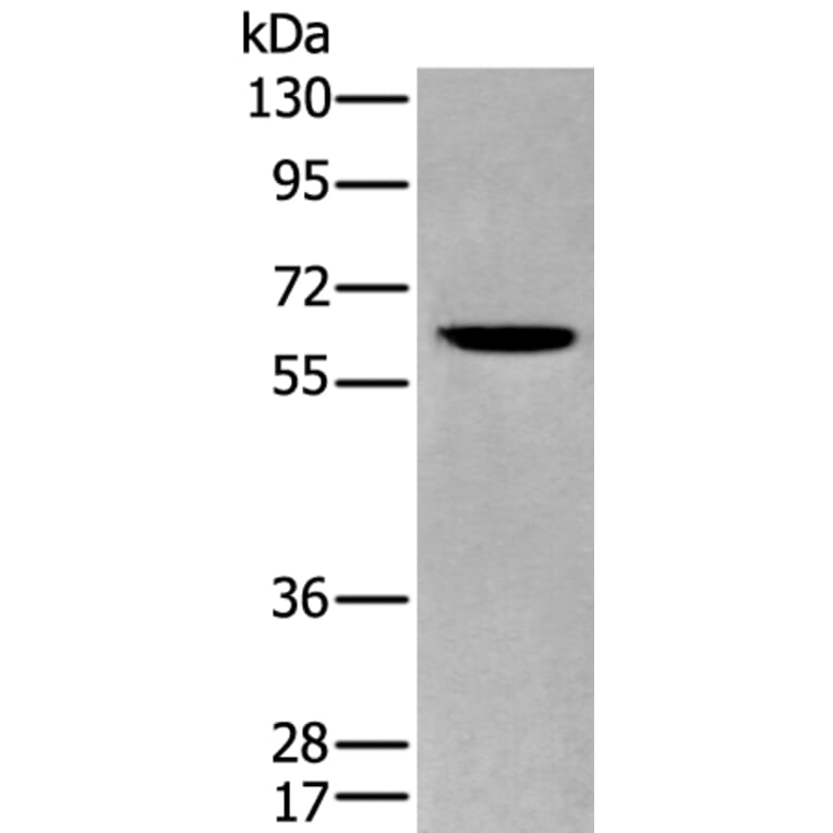ZKSCAN1 Antibody from Signalway Antibody (43569) - Antibodies.com