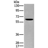 ZKSCAN1 Antibody from Signalway Antibody (43569) - Antibodies.com