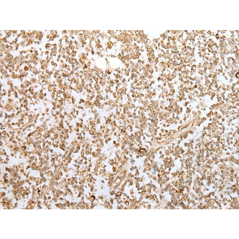 ZKSCAN1 Antibody from Signalway Antibody (43569) - Antibodies.com