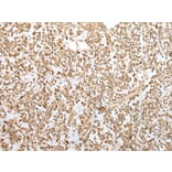 ZKSCAN1 Antibody from Signalway Antibody (43569) - Antibodies.com