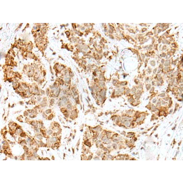 ZKSCAN1 Antibody from Signalway Antibody (43569) - Antibodies.com