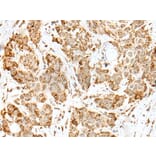 ZKSCAN1 Antibody from Signalway Antibody (43569) - Antibodies.com