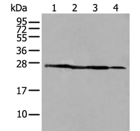 ARHGDIB Antibody from Signalway Antibody (43705) - Antibodies.com