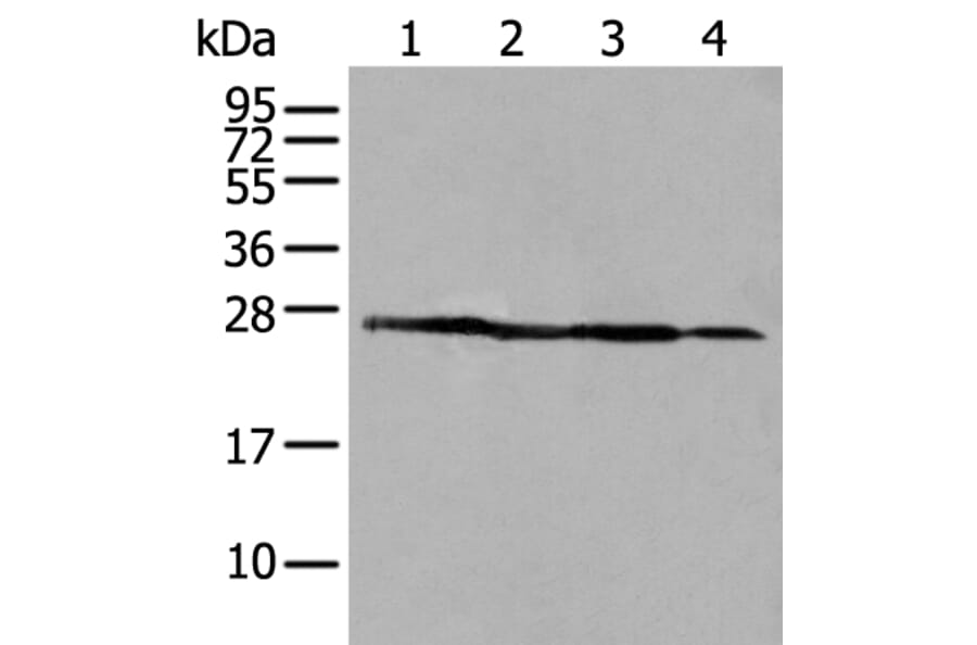ARHGDIB Antibody from Signalway Antibody (43705) - Antibodies.com