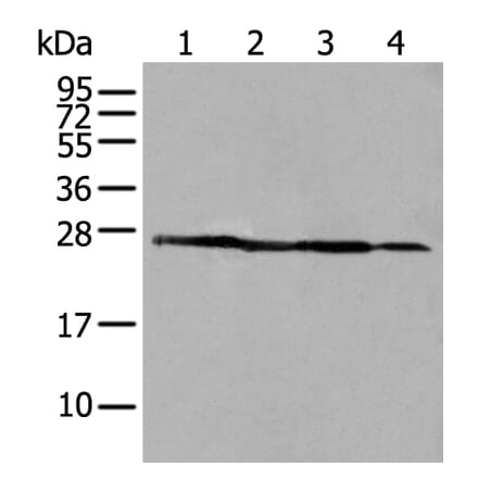 ARHGDIB Antibody from Signalway Antibody (43705) - Antibodies.com
