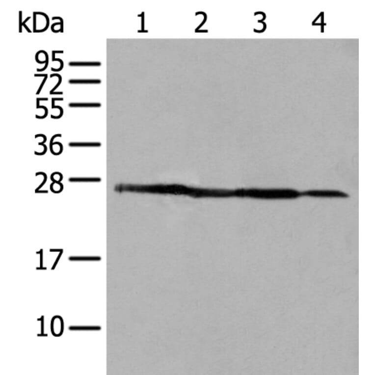 ARHGDIB Antibody from Signalway Antibody (43705) - Antibodies.com